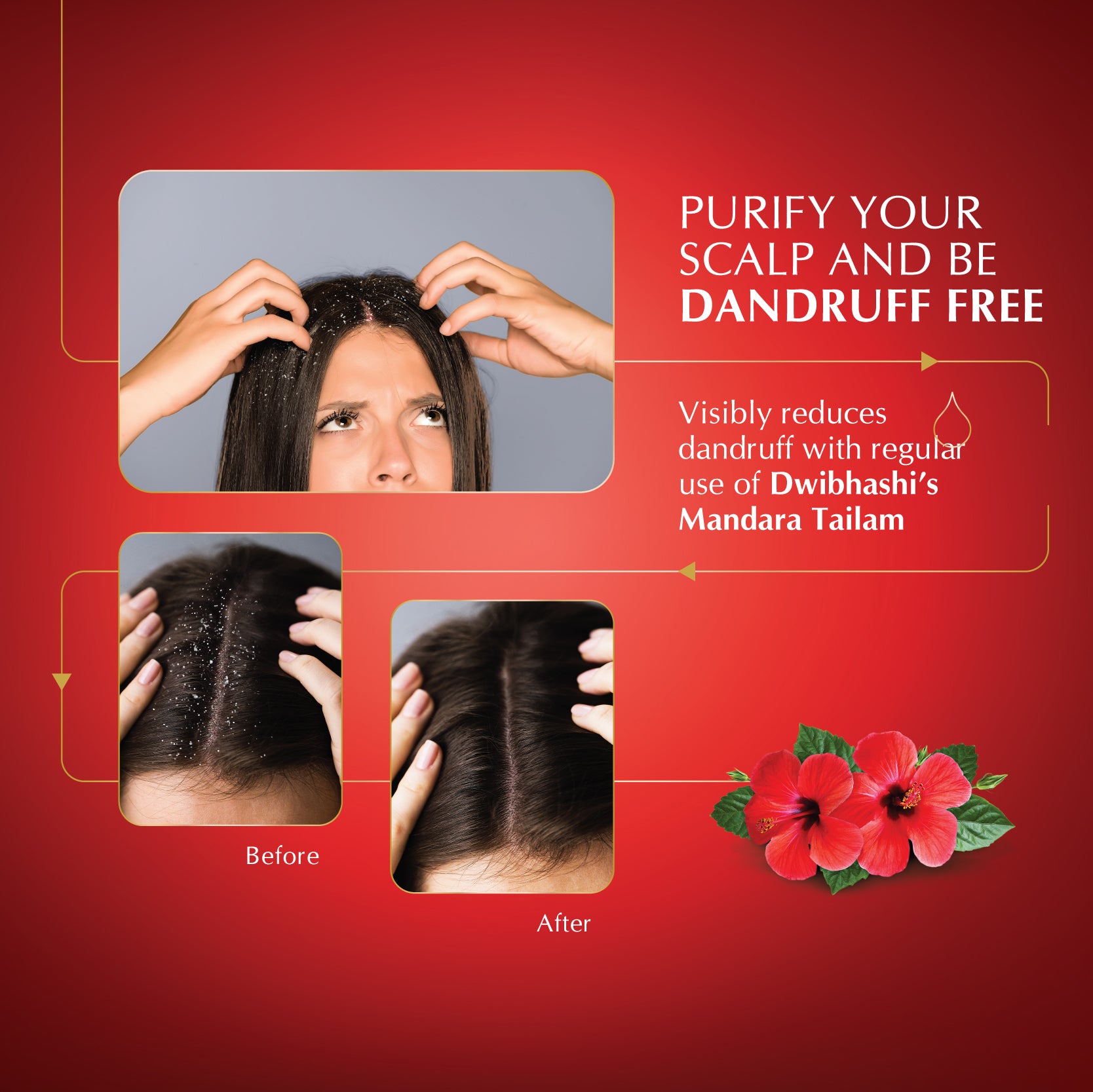 Mandara Tailam | Improves Hair Growth, Anti-Hairfall, Cures Dandruff | Hibiscus Oil| 100ml | 200ml